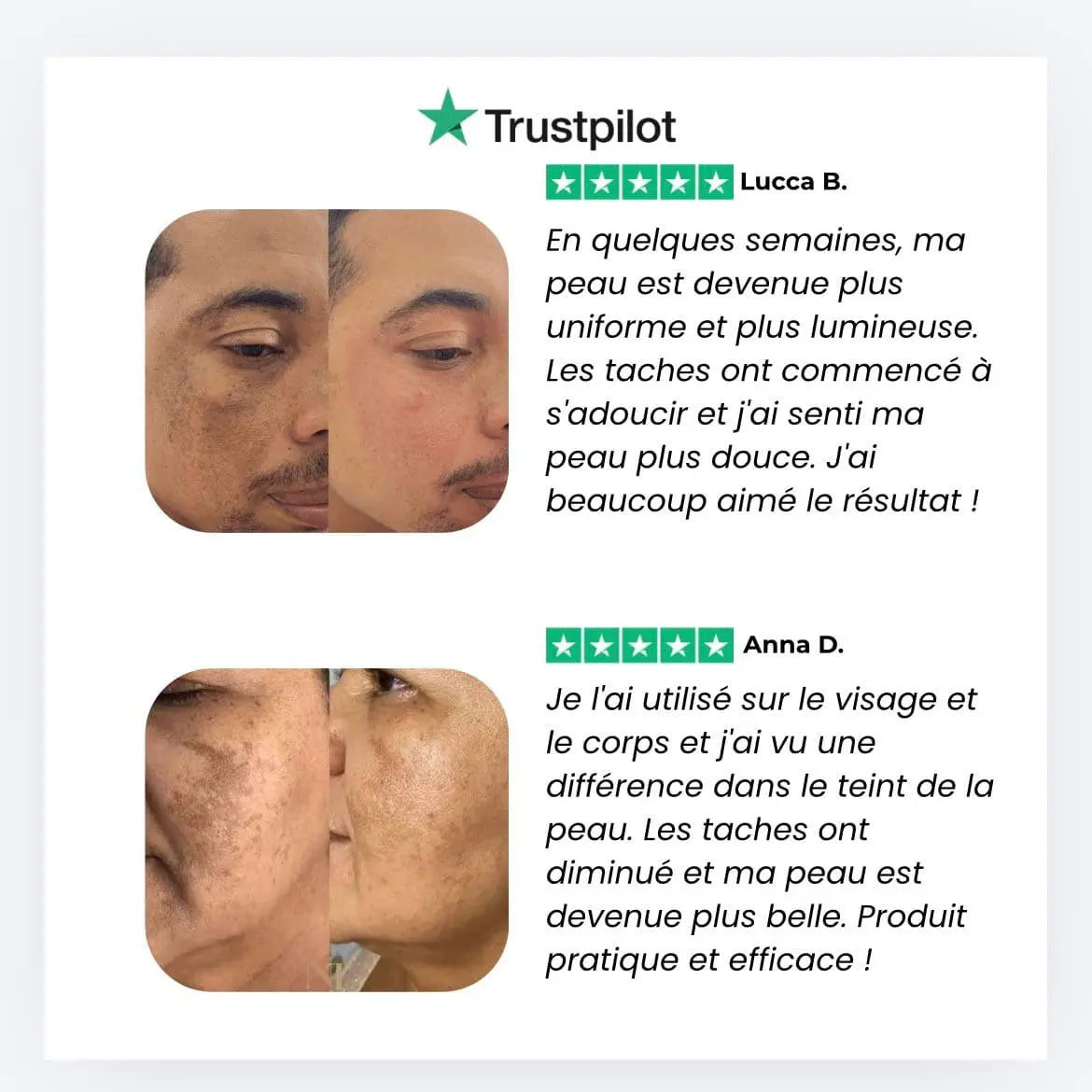 Savon Éclaircissant Intensif